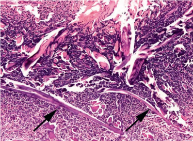 clinical figure