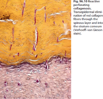 clinical figure