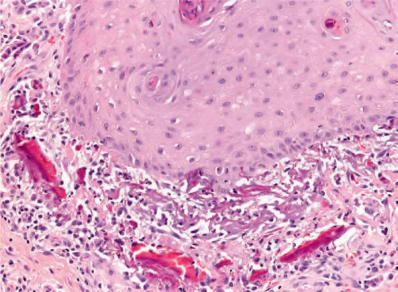clinical figure