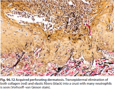 clinical figure